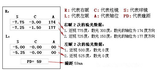 眼科醫(yī)生教你如何一分鐘看懂驗(yàn)光單！